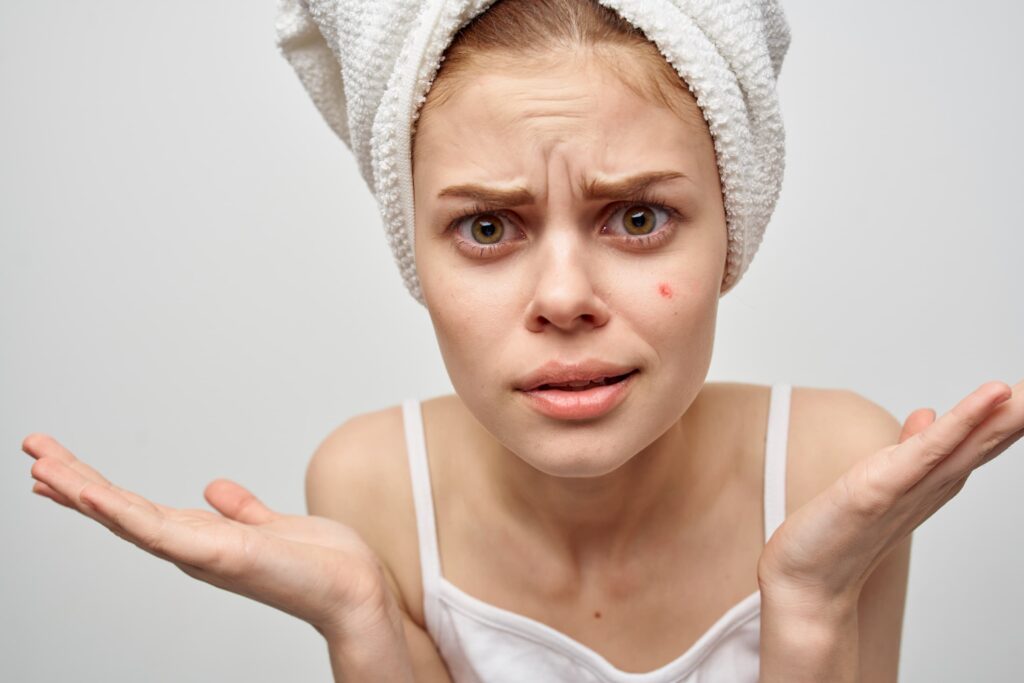Best Dermatology Treatments For Stubborn Acne Scars