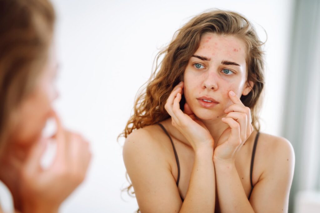 Common Skin Problems And Treatment Solutions