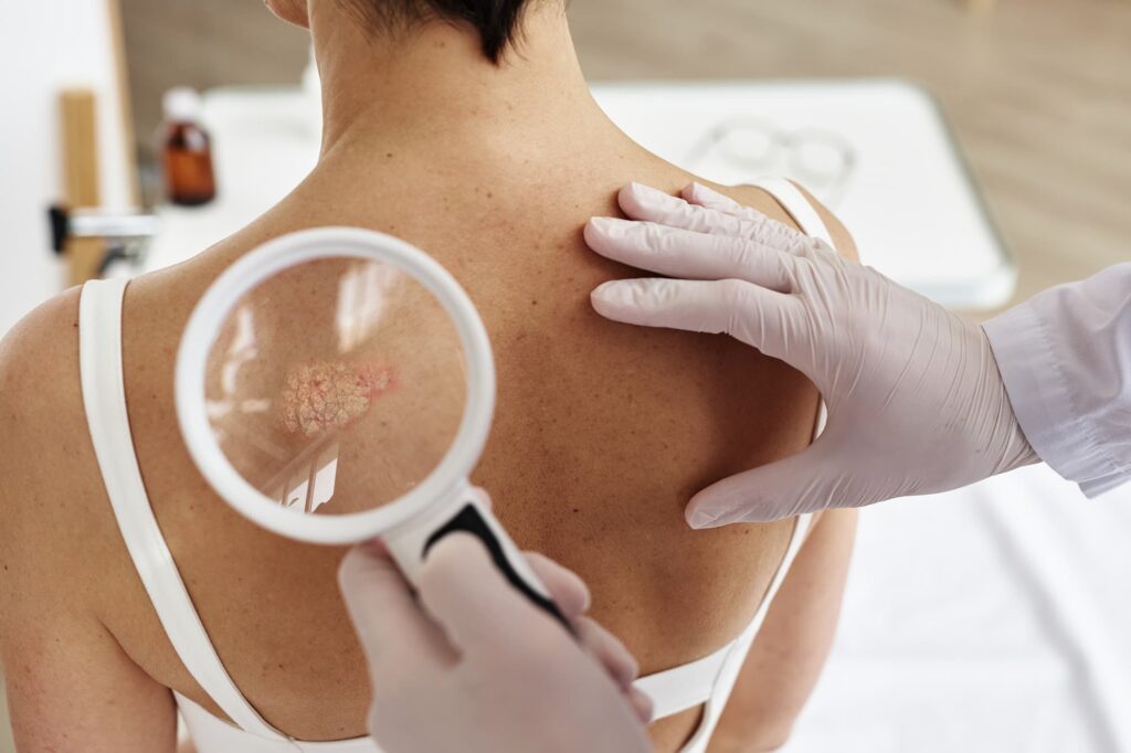 Benefits Of Dermatology Skin Consultations
