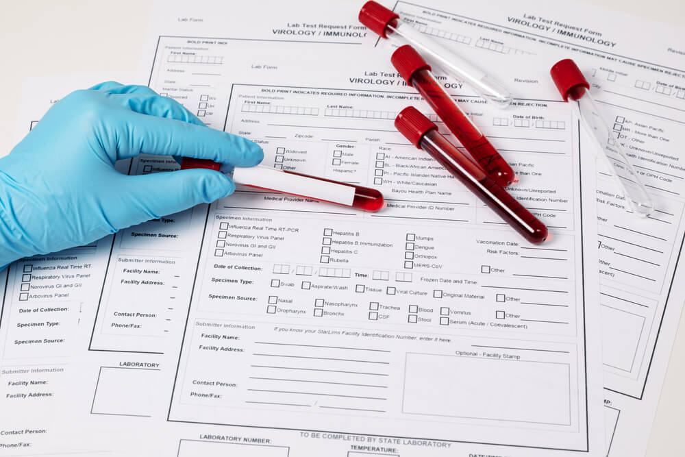 Reading Your Lab Results: A Simple Guide for Patients