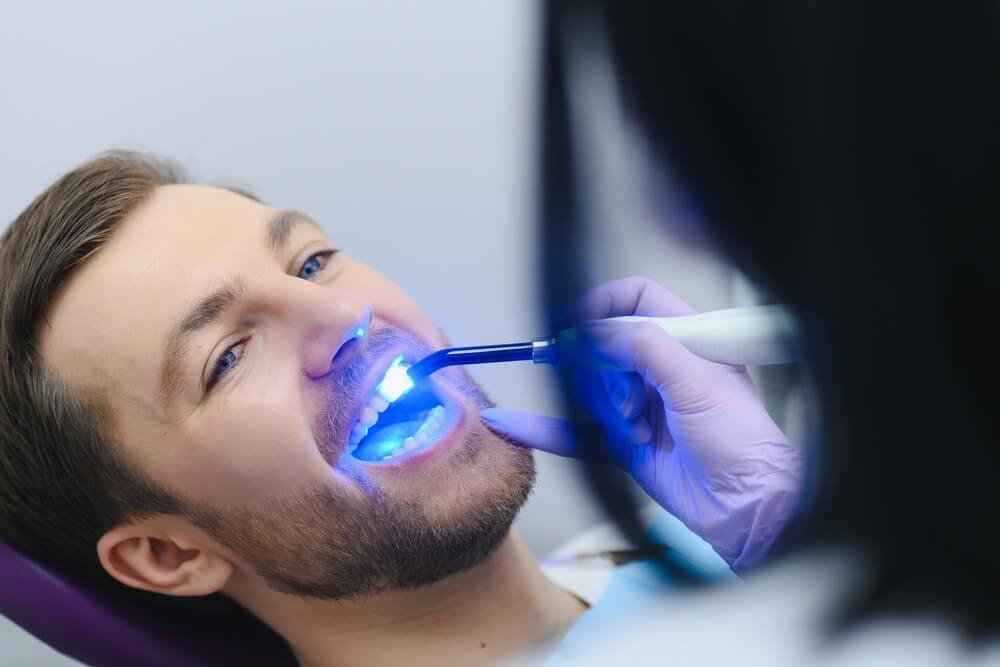 Teeth Whitening: What You Need to Know